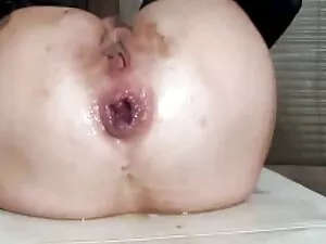 Garganta Submissa De ...
